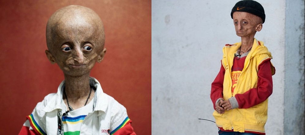 10 шокирующих мутаций человека