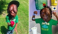 8 Year Old Boy With Massive Head Tumors Defies All The Bullies Calling Him "A Monster!"