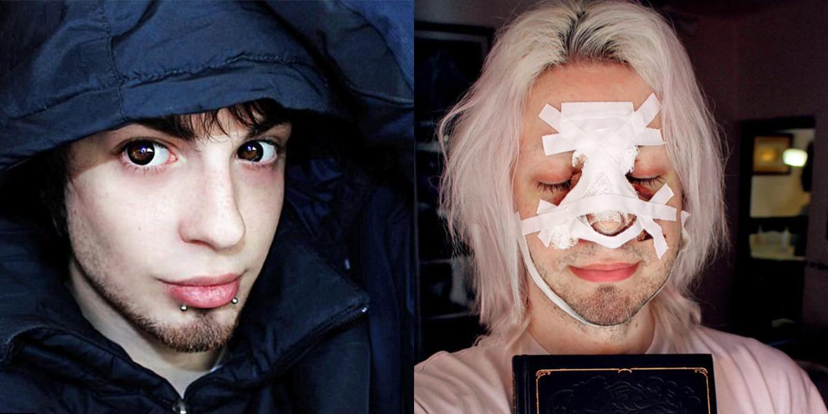 Argentinian Man Spends More Than 32 000 On Plastic Surgery To Become A Real Life Elf