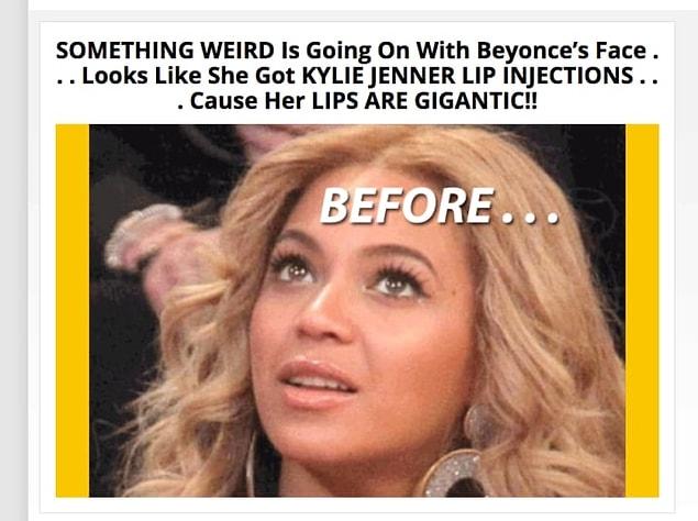 Earlier this week a story published on MediaTakeOut suggested that Beyonce's lips were recently surgically enhanced.