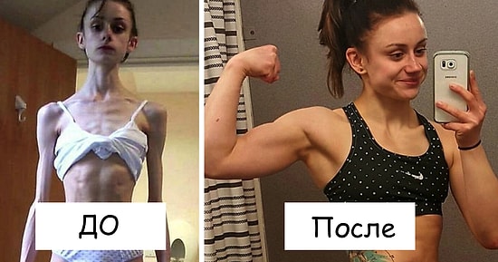 20 невероятных преображений людей, победивших анорексию