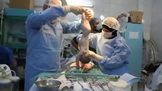 Watch: Doctors Trying To Bring A Stillborn Baby Back To Life Might Bring Tears To Your Eyes!