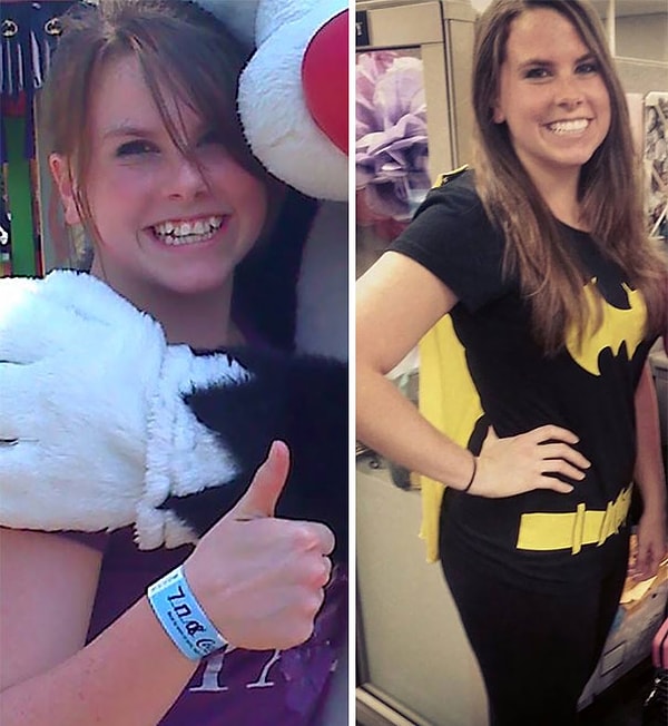 6. "Не стоит недооценивать силу брекетов"