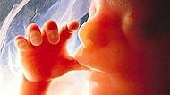 Kürtaj Hakkında İleri Geri Konuşmadan Önce Mutlaka Öğrenilmesi Gereken 14 Bilgi