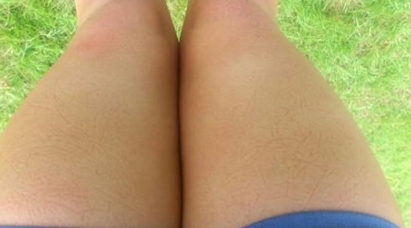 2. Вот такими "узорами" ваши ноги покрываются после того, как вы посидите на стуле: