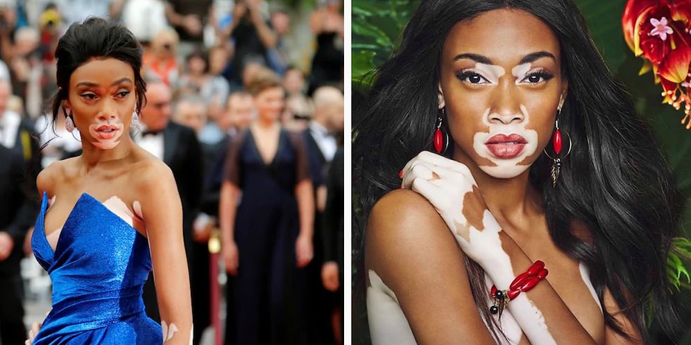 Винни Харлоу доказывает, что, быть не такой, как все - это прекрасно!