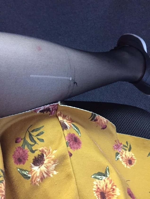9. That minor tragedy that occurs the moment you walk out of the house in pantyhose.