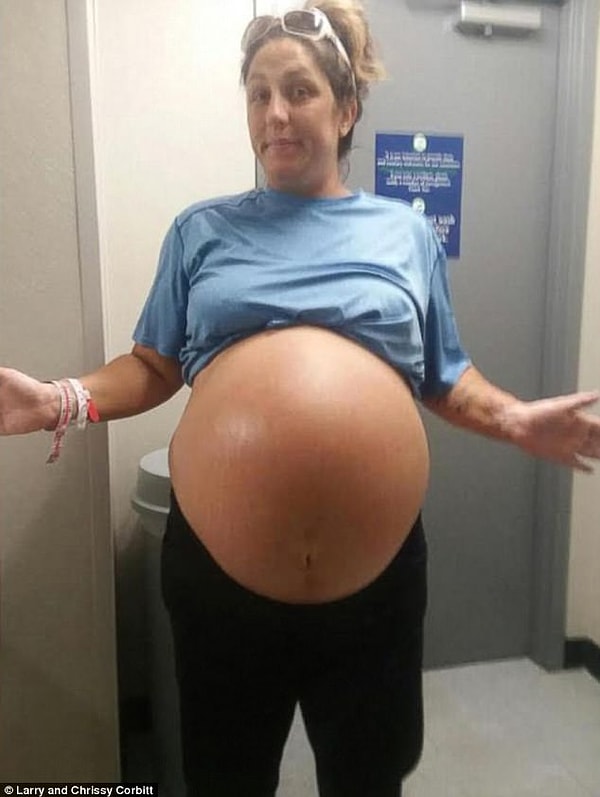 2. Живот мамочки был таким огромным, что врачи ожидали появления двойняшек.