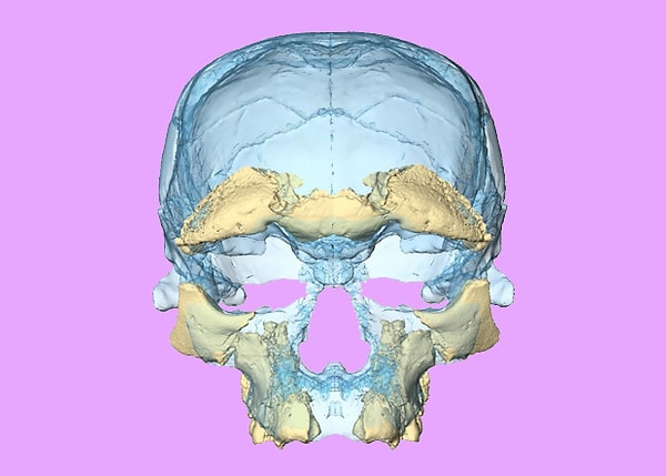 5. Обнаруженные в Марокко фрагменты — части черепа, нижняя челюсть, часть верхней челюсти, шесть зубов и несколько костей конечностей — принадлежали троим взрослым, подростку и ребенку