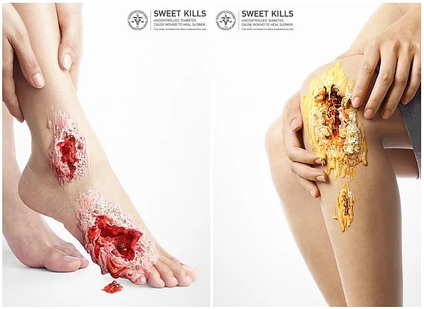 3. Сахар убивает. Социальная реклама, рассказывающая о сахарном диабете