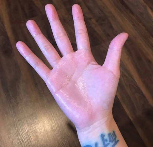 1. Вы не можете держать кого-то за руку дольше 5 секунд, иначе страдать от вашей потливости будете не только вы сами...