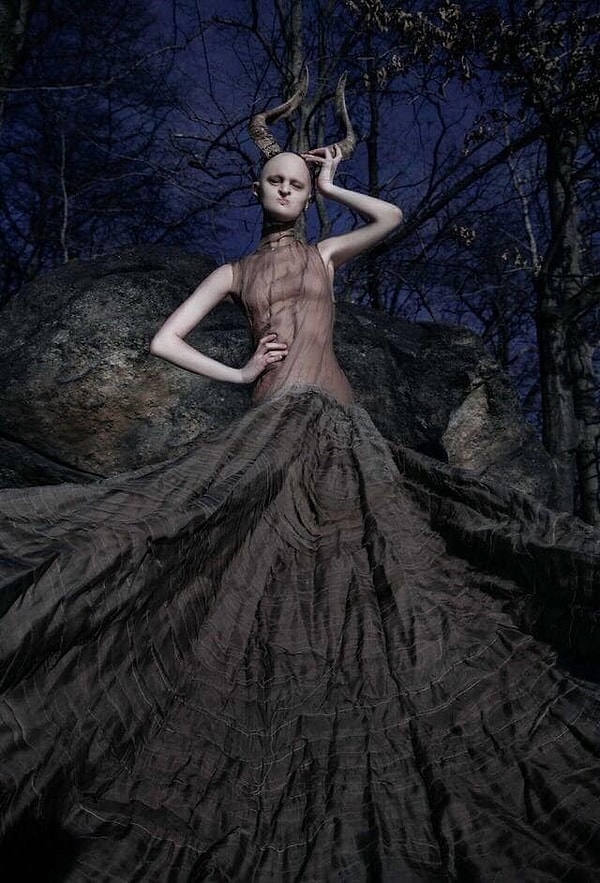 2. Мелани страдает тяжёлой формой данного заболевания. У девушки двусторонняя расщелина нёба, а также особая форма алопеции - волосяные фолликулы растут вовнутрь кожи. Ещё когда она была ребёнком ресницы начали расти так, что повредили роговицу глаза, поэтому Мелани страдает частичной слепотой.