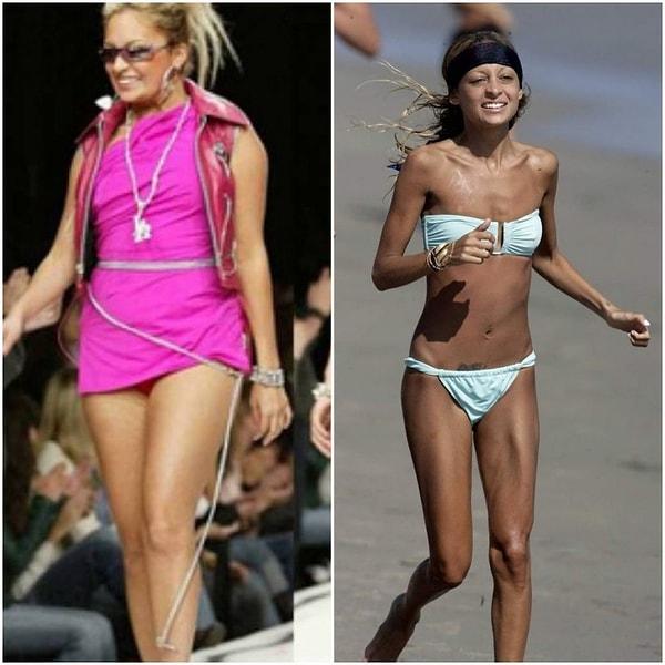 16. Nicole Ritchie, 2006 yılında nedendir bilinmez aniden 40 kiloya düştü ve inanılmaz sağlıksız görünüyordu!
