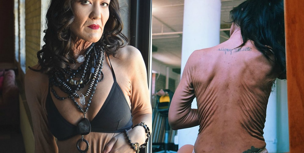 Эта 26-летняя девушка заставила многих поменять свои понятия о красоте