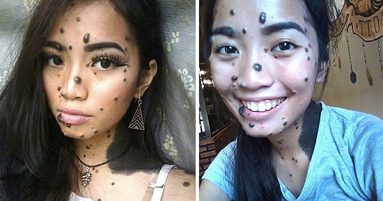 Девушка, которую обзывали монстром из-за ее родинок, может стать следующей Мисс Вселенная