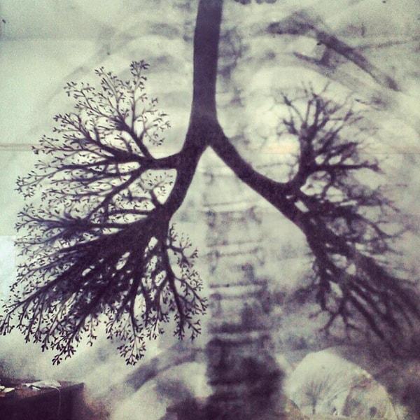 7. Nefes borusunun akciğerlere yayılımı.