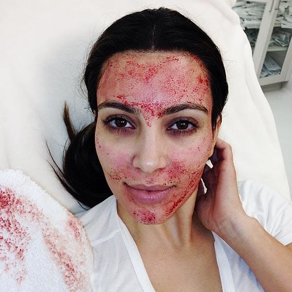 3. Лицо Ким Кардашян в крови...