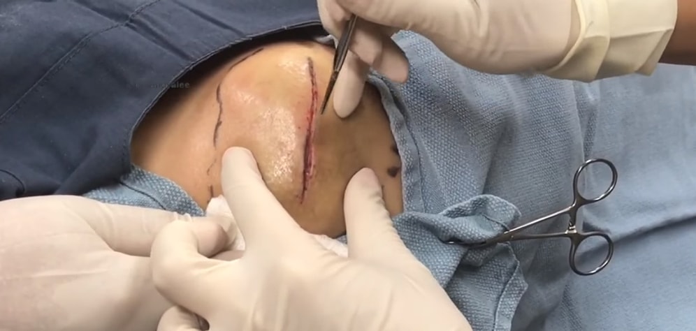 İçinden Çıkanlarla Şaşkınlık Yaratan 50 Yıllık Kistin, İzlemesi Aşırı Keyifli Boşalma Görüntüleri