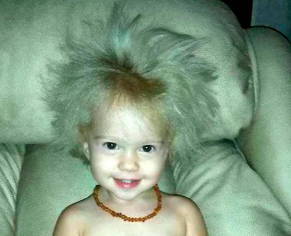 Arkansas'ta yaşayan Sara 'Jaili küçükken çok güzel ve normal bebek saçları vardı, ama sonradan döküldüler ve yerine bu tuhaf saçlar çıkmaya başladı.' dedi.