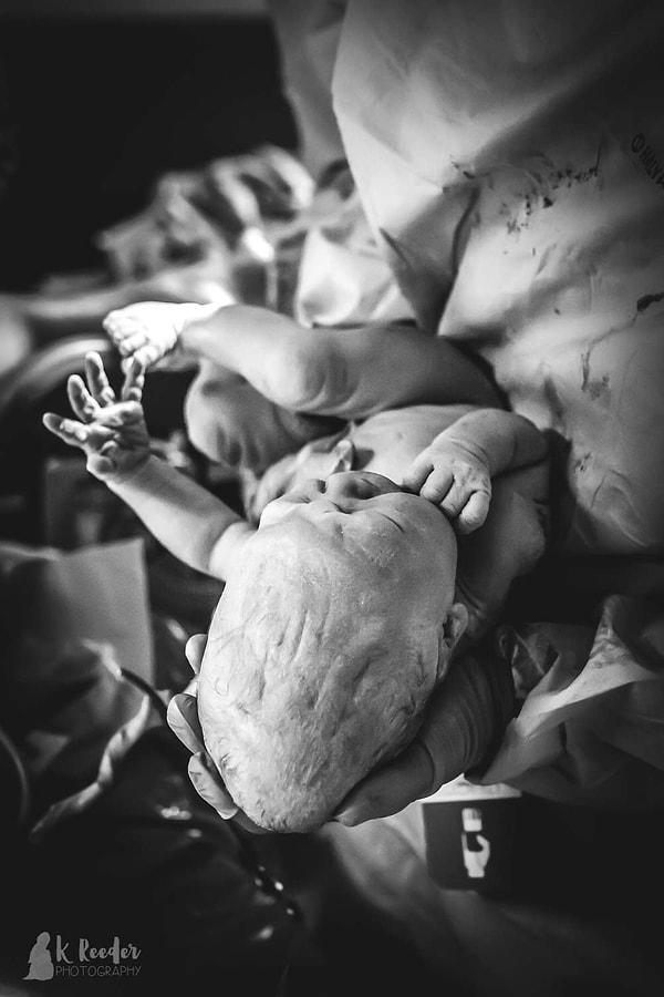 Fotoğrafçı Kayla Reeder'ın çektiği doğum fotoğraflarında, bir bebeğin doğum sırasında kafasının koni şeklini aldığı görülüyor.