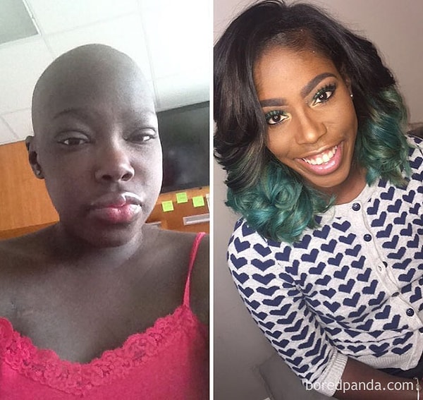 10. "К черту рак - я победила!"