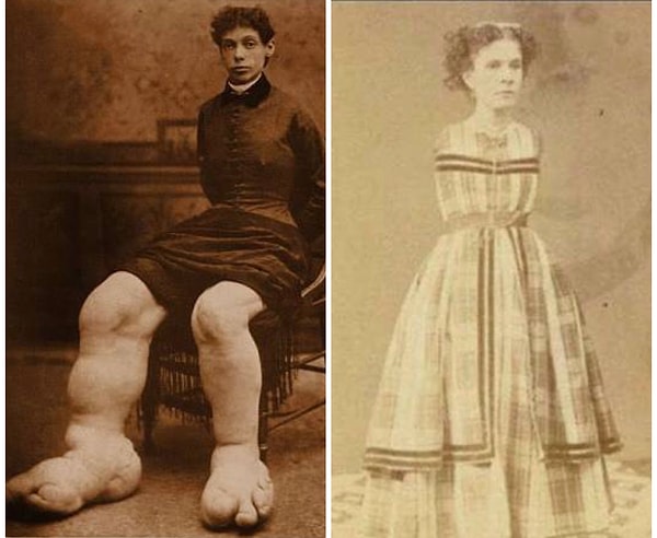 12. Цирковые артистки с гигантскими ногами и без рук.