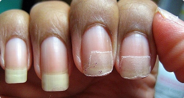 12. Ты проходишь через множество стадий: боль, разочарование, обида, смирение, принятие...