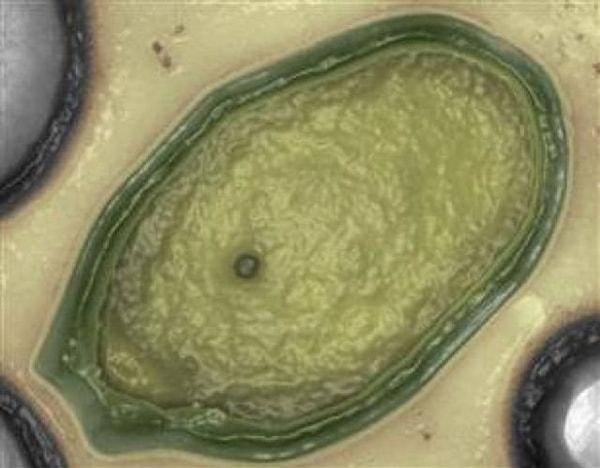 9. Pandora isimli dünyanın en büyük virüsü Avustralya sahilinde bulundu ve genetik yapısının %93'ü tanımlanamadı.