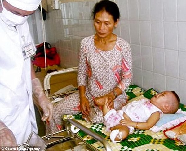 2. Хэйвен Шеперд сейчас 14, но когда она была совсем ребенком, то потеряла обе ноги от колена и ниже, так как ее родители взорвали себя.