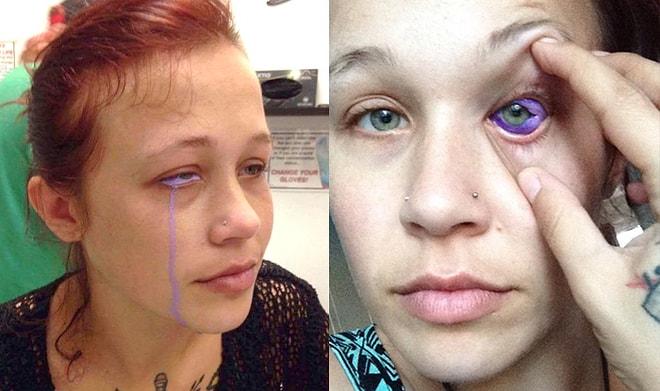 Yaptırdığı Dövme Sonrasında Gözünü Kaybetme Noktasına Gelen Kadın