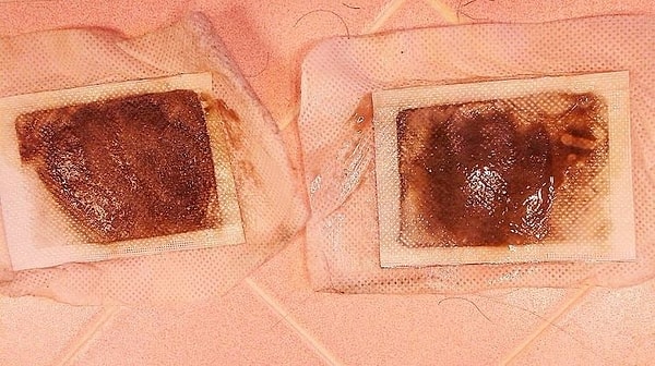 3. Использованные пластыри выглядят отвратительно, но это свидетельствует о том, что метод работает!