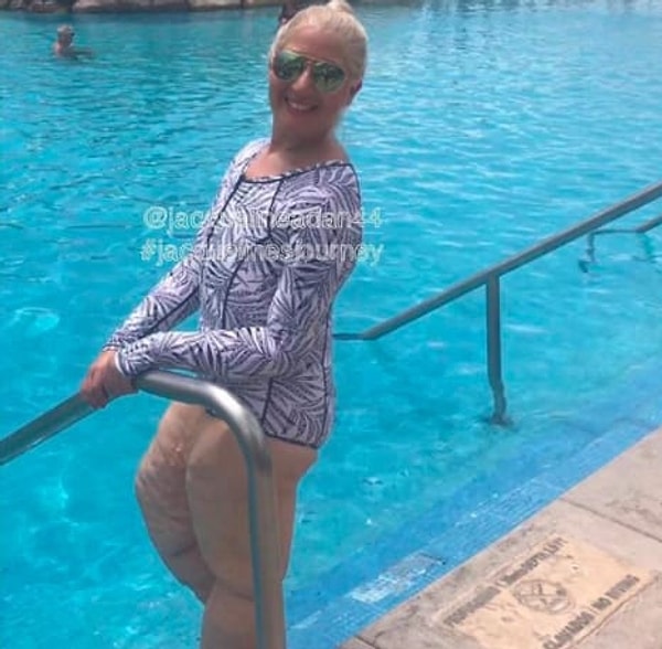 4. "И вот это произошло. Парочка, сидевшая у бассейна, начала смеяться и тыкать в меня пальцем, как только я сняла одежду".