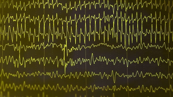 6. Врачи в сериалах очень нелепо борются с приступами пациентов