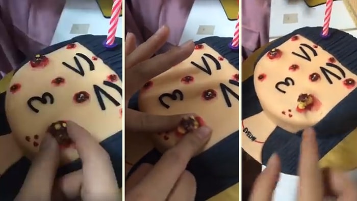 Hastasına Dünyaları Vadeden Bir Pasta: Sivilce Sıkmalı Pasta