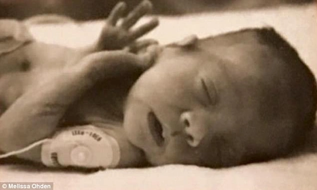 Однако что-то пошло не так, ребенок выжил, и одна из медсестер, обнаруживших его, тут же отнесла его в отделение для новорожденных.