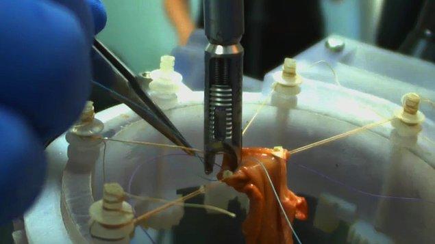 Cerrahlar, parçalanmış ya da delinmiş organları onarmak amacıyla yaraları kaynaştırmak için cerrahi zımba, dikiş ipleri ve telleri kullanırlar.