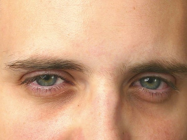 5. А что вы видите в глазах этого человека?