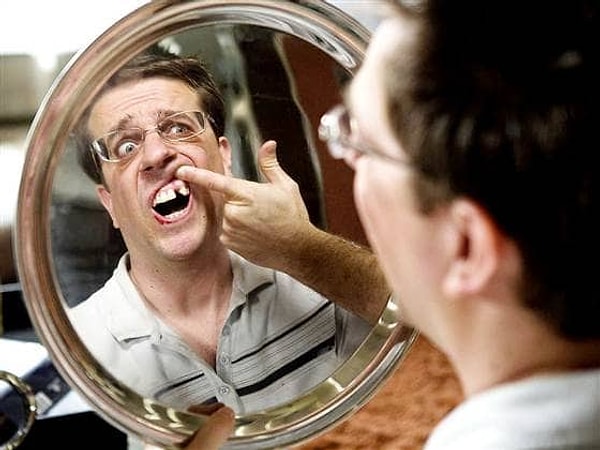 6. В «Мальчишнике в Вегасе» у Эда Хелмса нет зуба по-настоящему