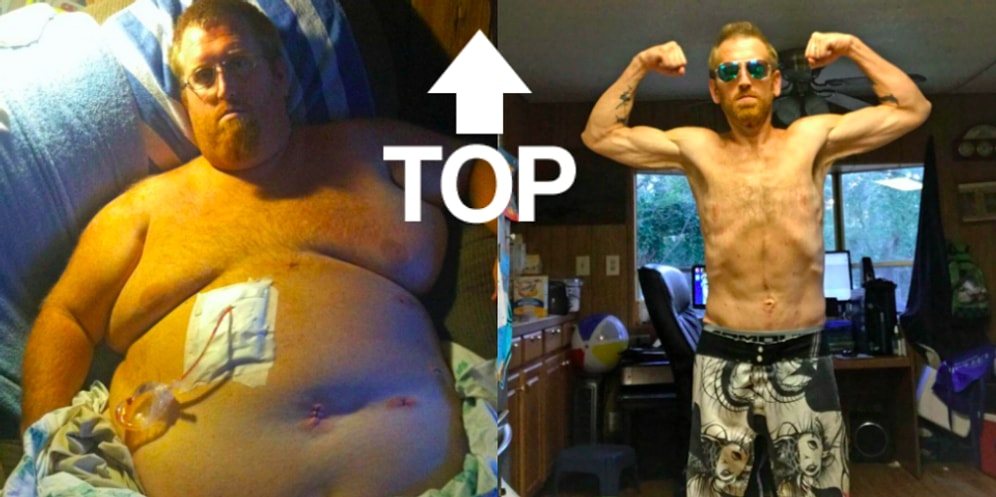 Американец, которому грозила смерть от ожирения, похудел на 160 кг 😱
