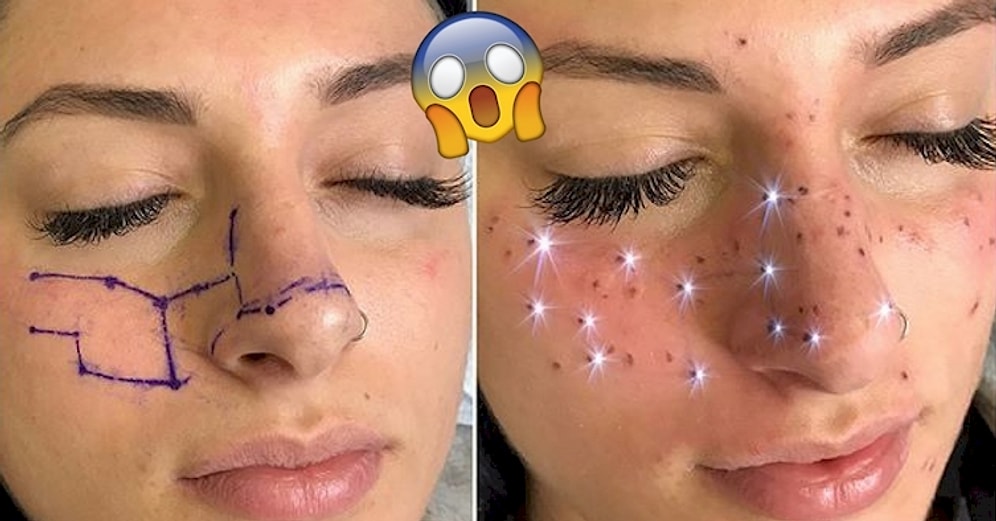 Такие девушки как звёзды? Встречайте новый тренд: астровеснушки!