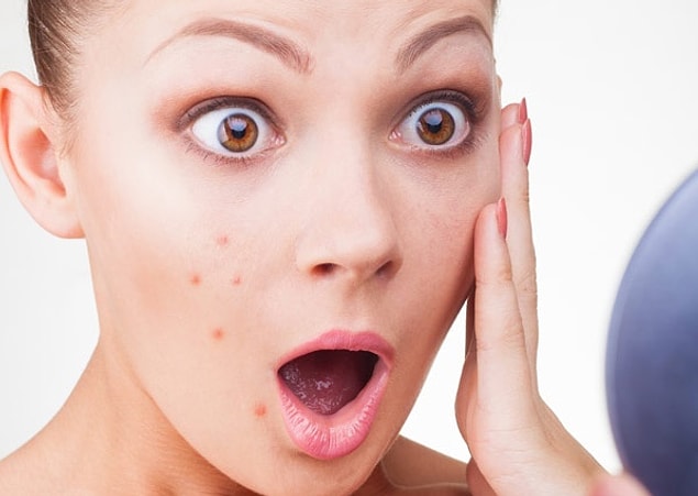 Ancak bu geçici bir durum değilse, ergenliği atlattığınız halde düzenli sivilce probleminiz varsa gitmeniz gereken ilk doktor dermatolog değil.