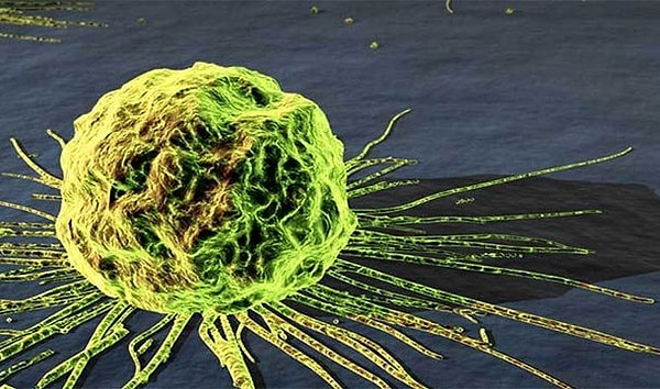 12. Недостаток сна увеличивают шансы возникновения некоторых видов рака