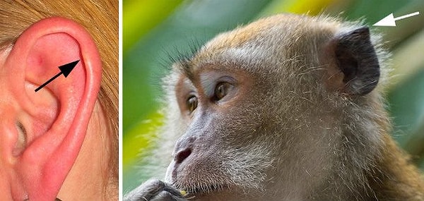 5. Дарвинов бугорок