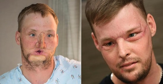 Привет с того света: душераздирающая встреча вдовы с человеком, получившим лицо ее мужа