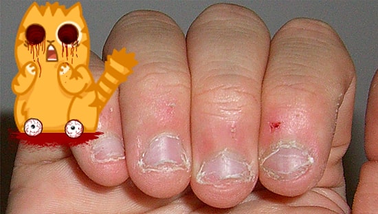 Если вы грызёте ногти, то эти 9 фактов навсегда отобьют у вас охоту это делать!