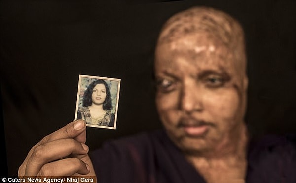 Рани перенесла множество пластических операций и других медицинских лечебных процедур.