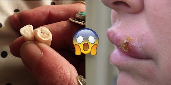 Tırnaklarını Yemekten Vazgeçemeyenler Bu Gerçeklerden Sonra Bir Daha Ağızlarına Bile Sürmeyecekler!