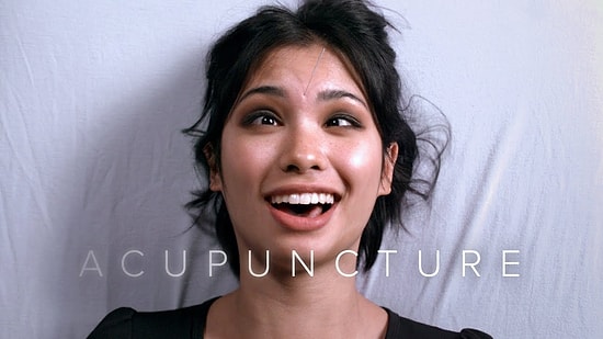 Hayatlarında İlk Defa Akupunktur Yaptıran İnsanların Ağır Çekimdeki İnanılmaz Surat İfadeleri