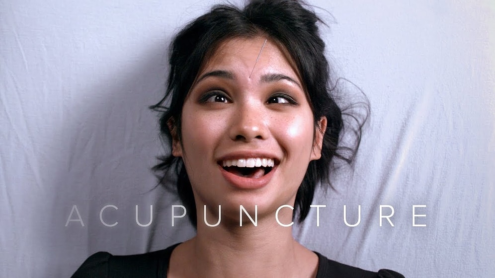 Hayatlarında İlk Defa Akupunktur Yaptıran İnsanların Ağır Çekimdeki İnanılmaz Surat İfadeleri