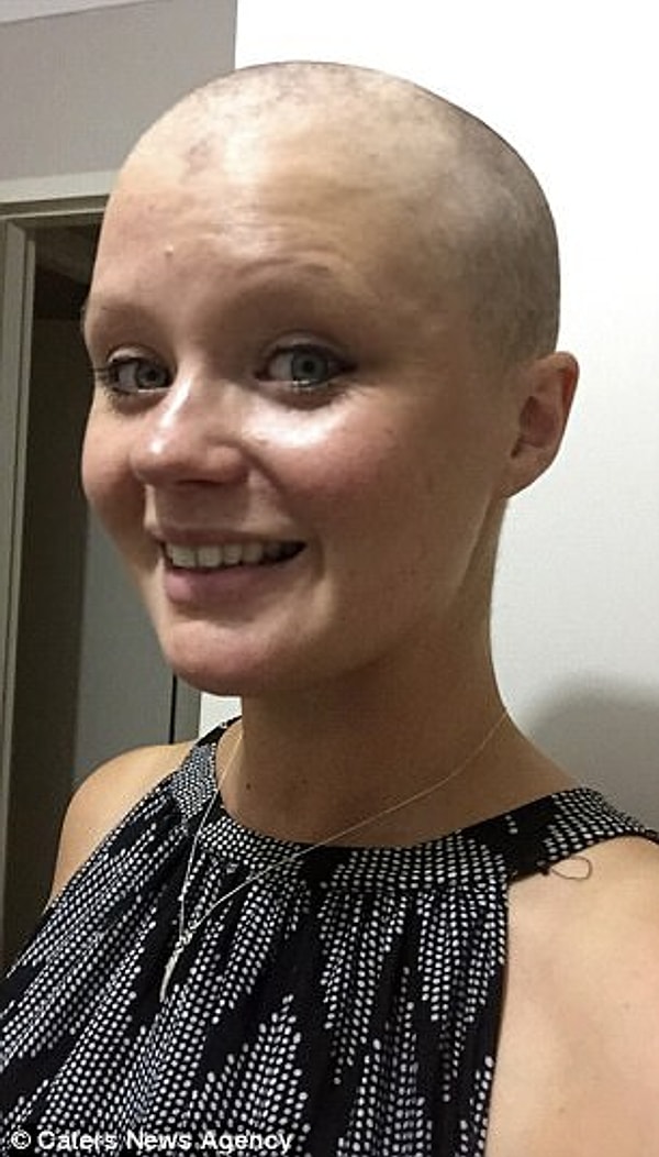 4. Даже после операции и химиотерапии, которая далась Ноулз очень нелегко, опухоль продолжала расти.